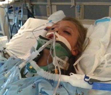 brain injury patient on life support